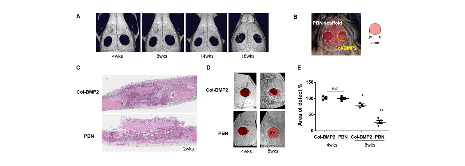 2) Calvarial critical size defect model