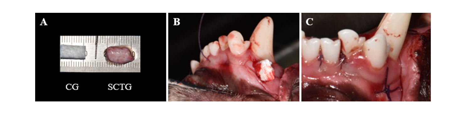 1) Soft tissue augmentation model