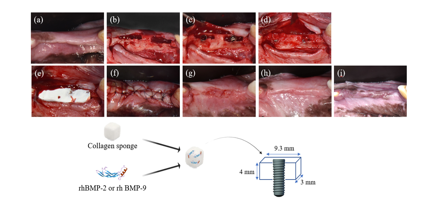 2) Dental Implant model